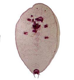   Planchonia stentae  